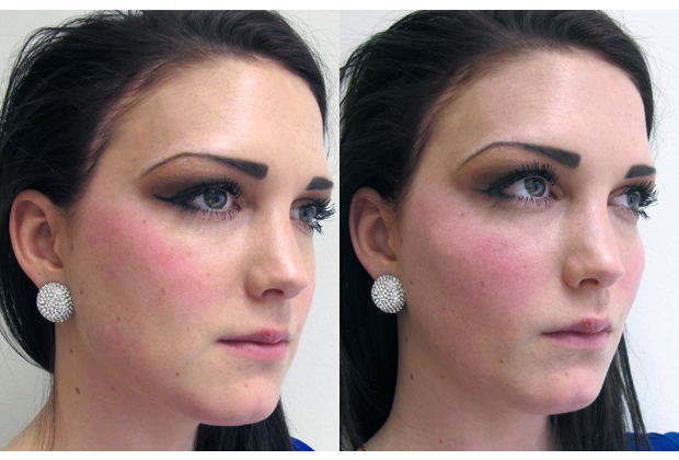 fillers i kinderna bilder
