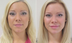 stureklinikencarrobeforeafter