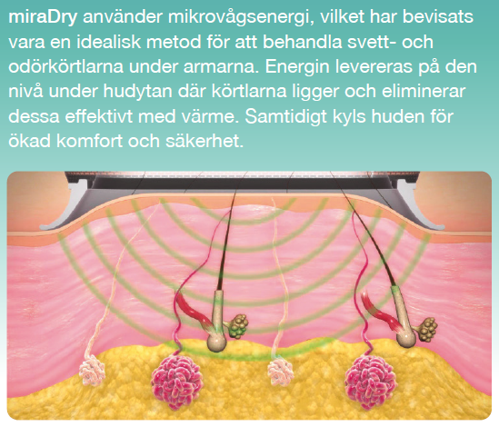 hur-fungerar-miradry